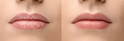 Overnight Lip Treatment
